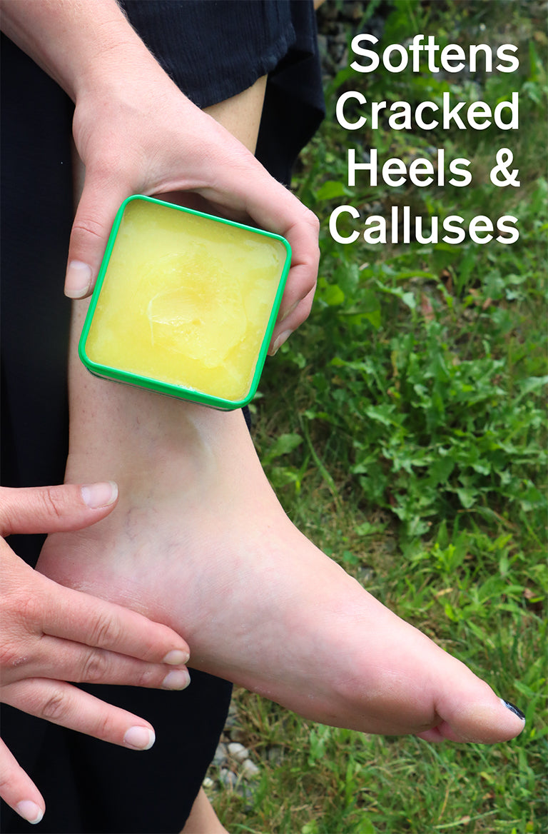 8oz tin of Bag Balm - Softens Cracked Heels & Calluses